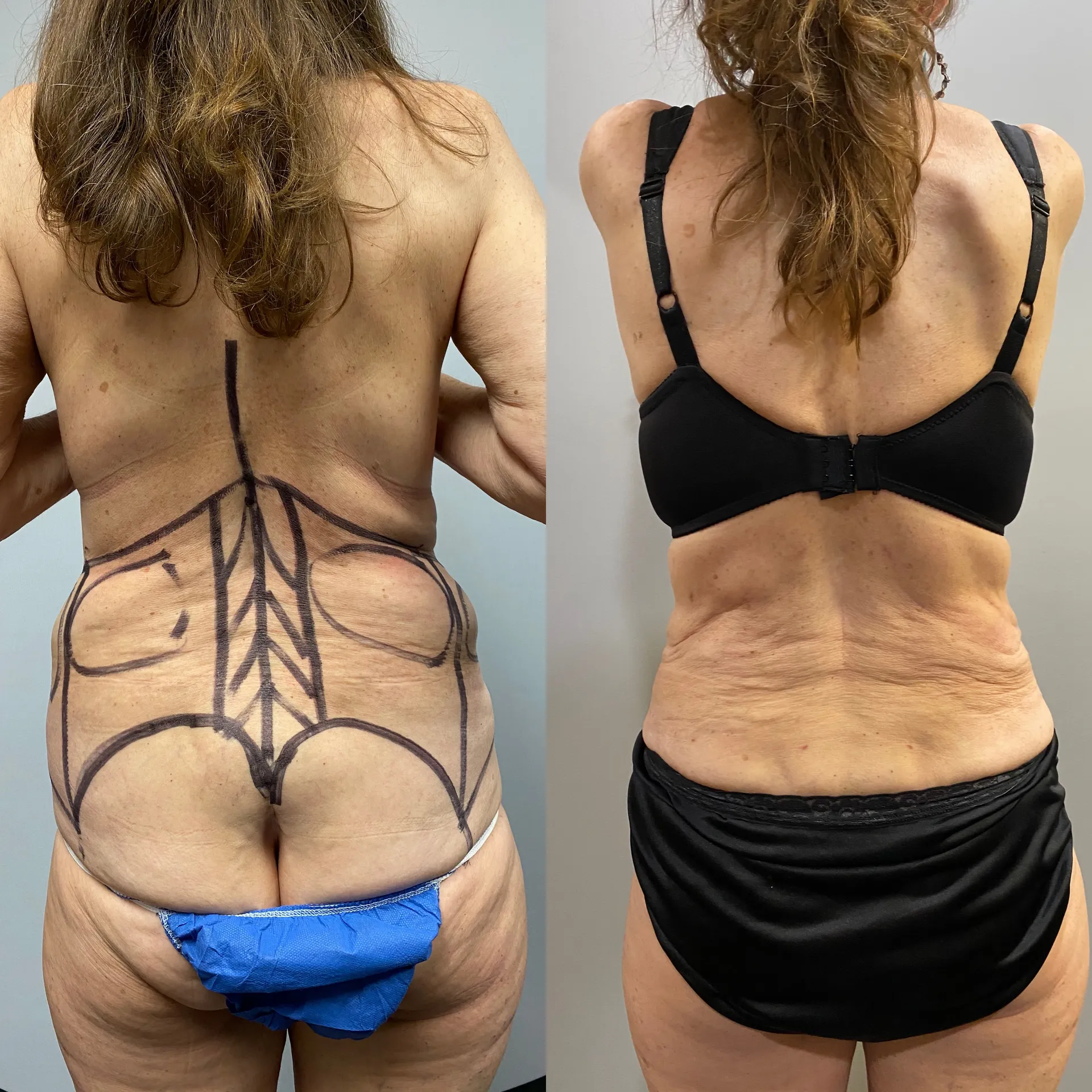 Results before & after — case 45