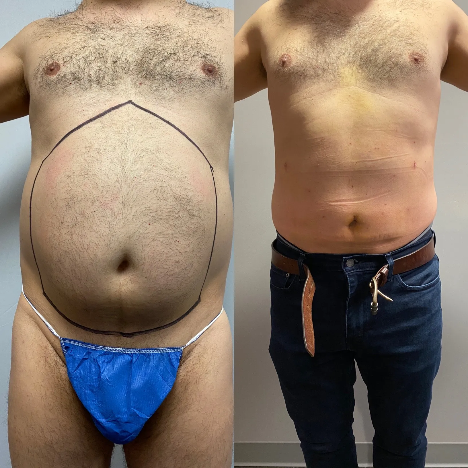 Results before & after — case 49