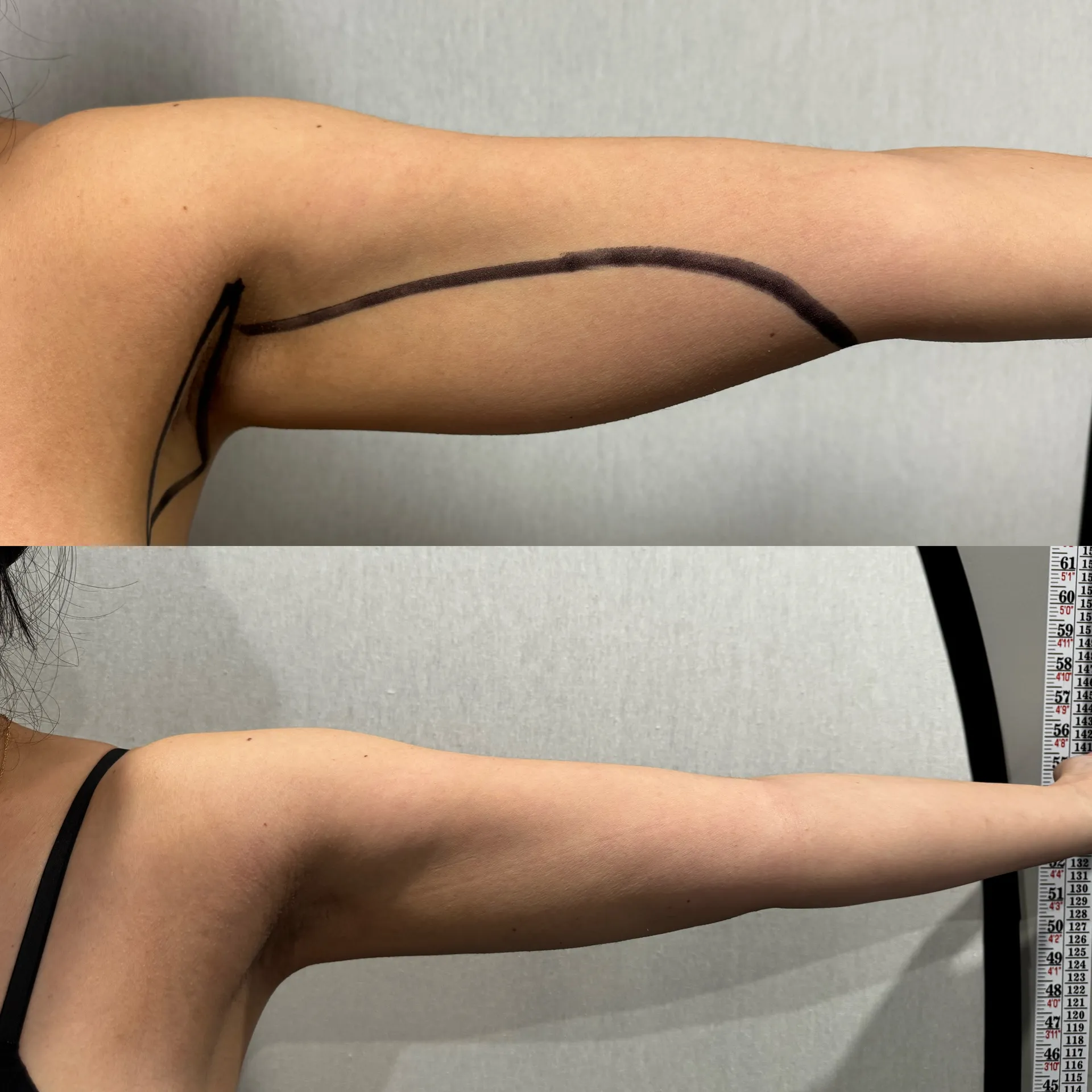 Featured before & after — case 40