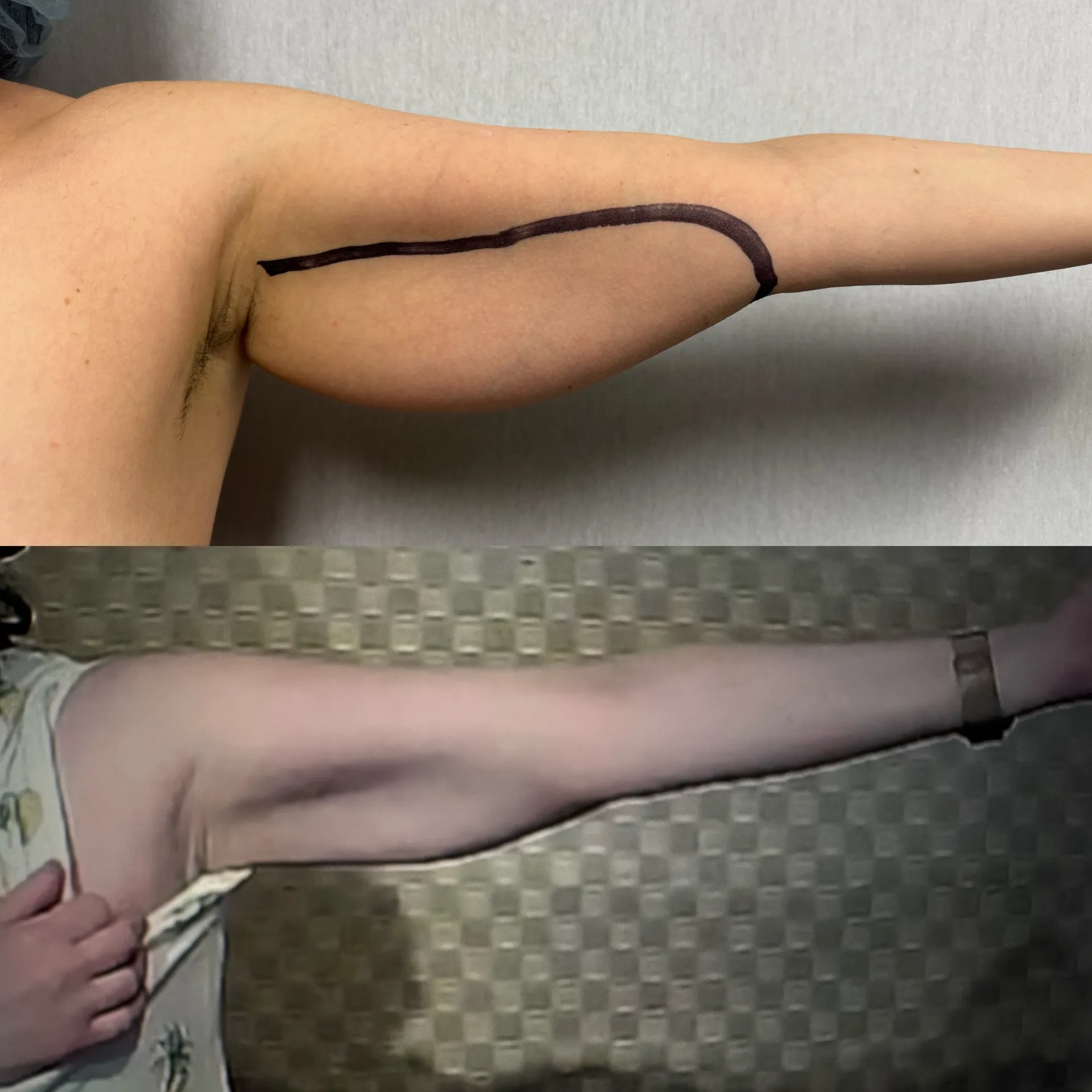 Featured before & after — case 37