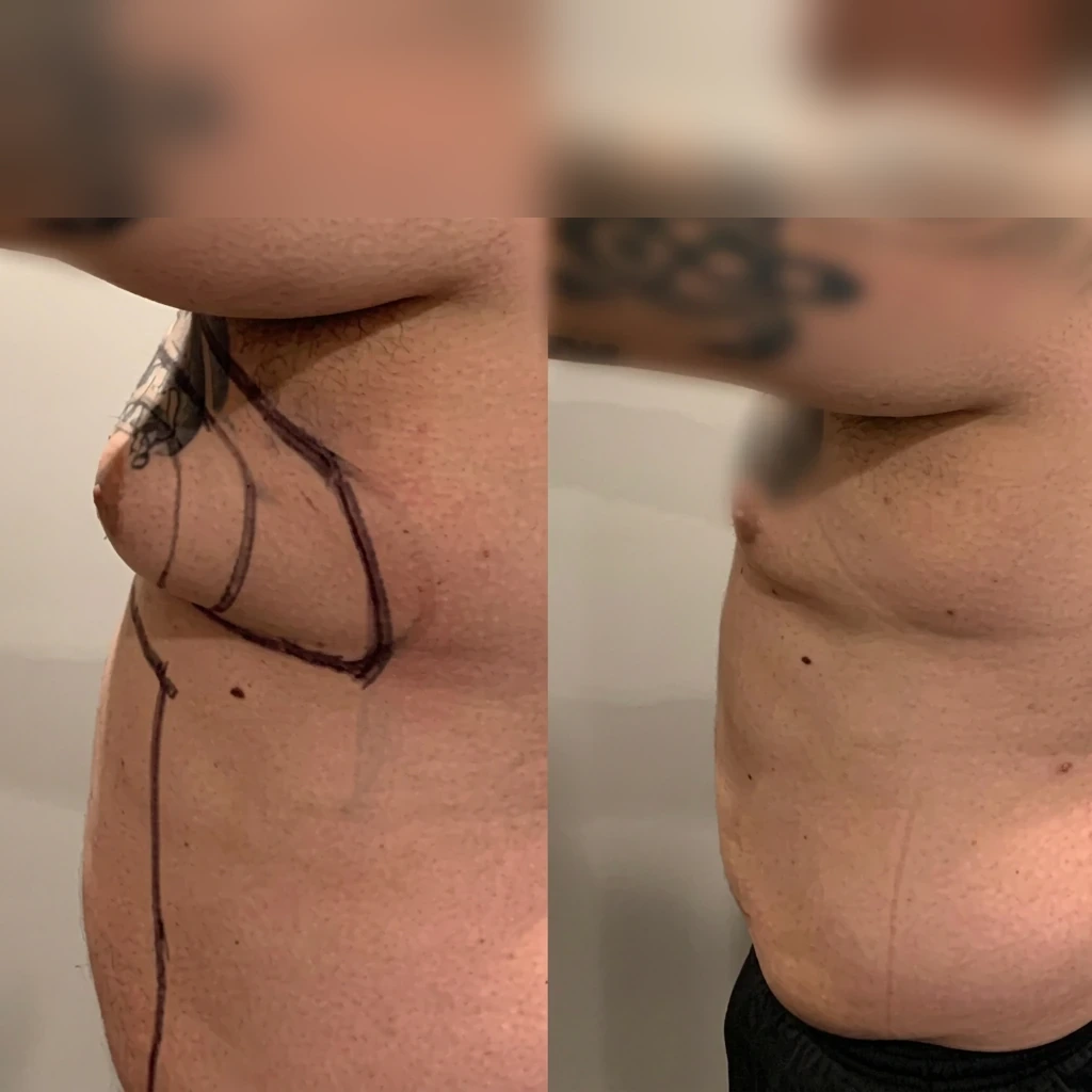 Men — Chest