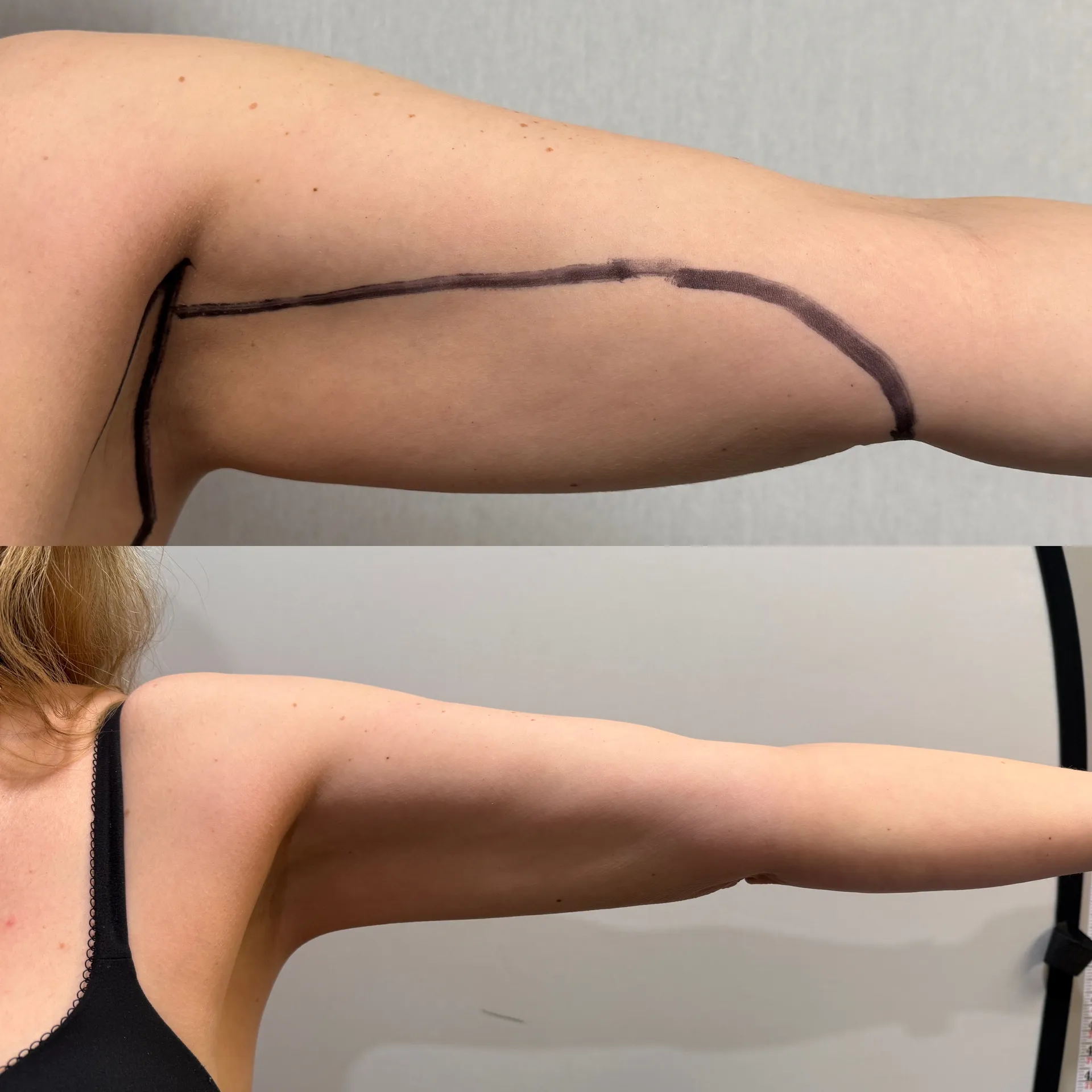 Featured before & after — case 36
