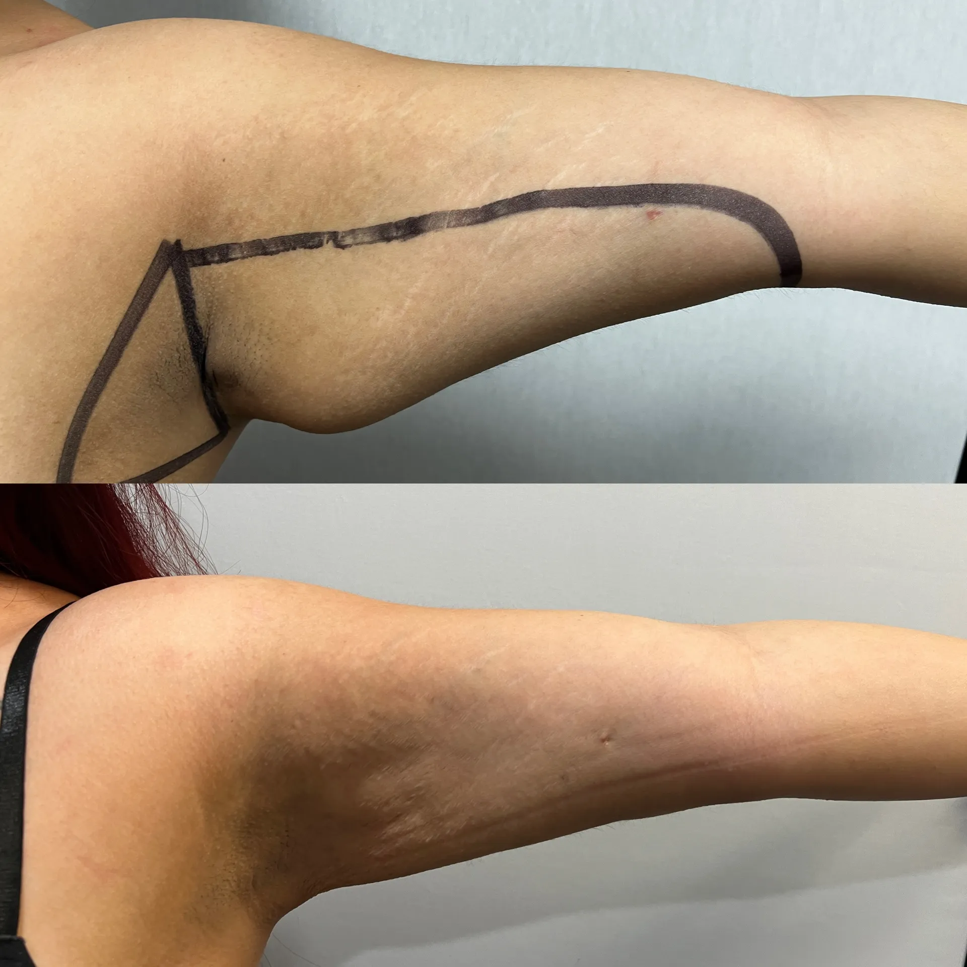 Featured before & after — case 35