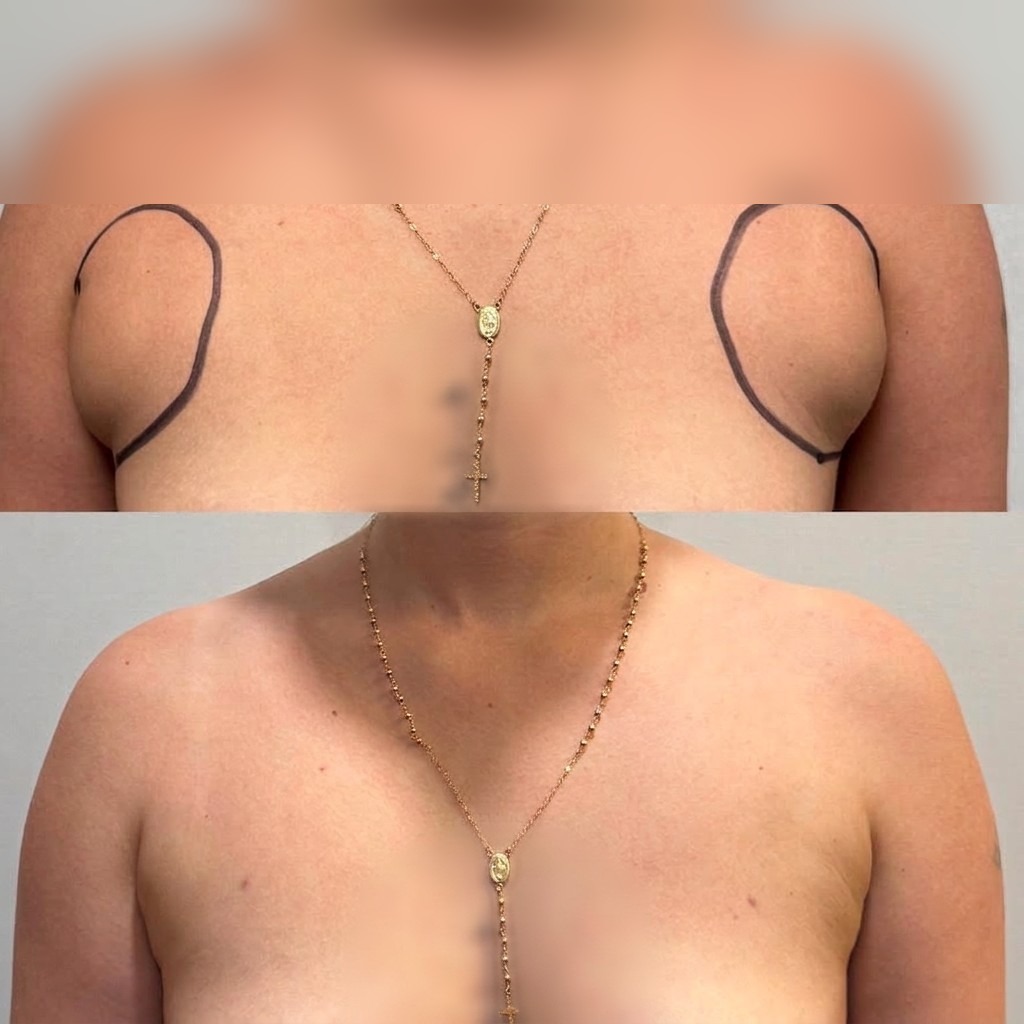 Women — Bra-Line