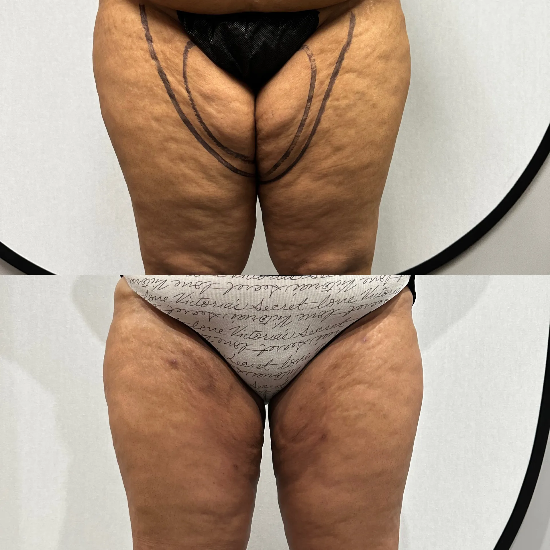 Results before & after — case 43
