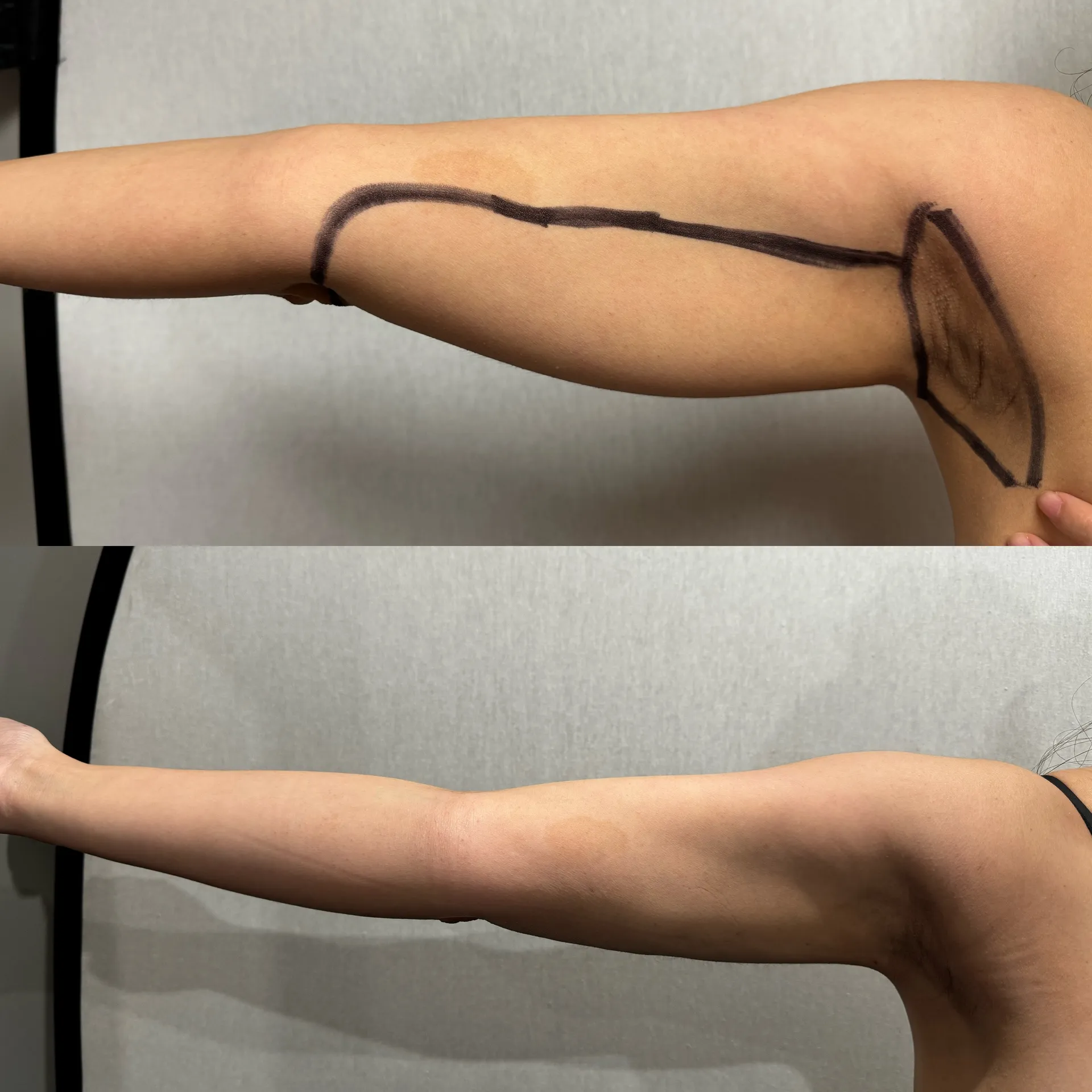 Featured before & after — case 39