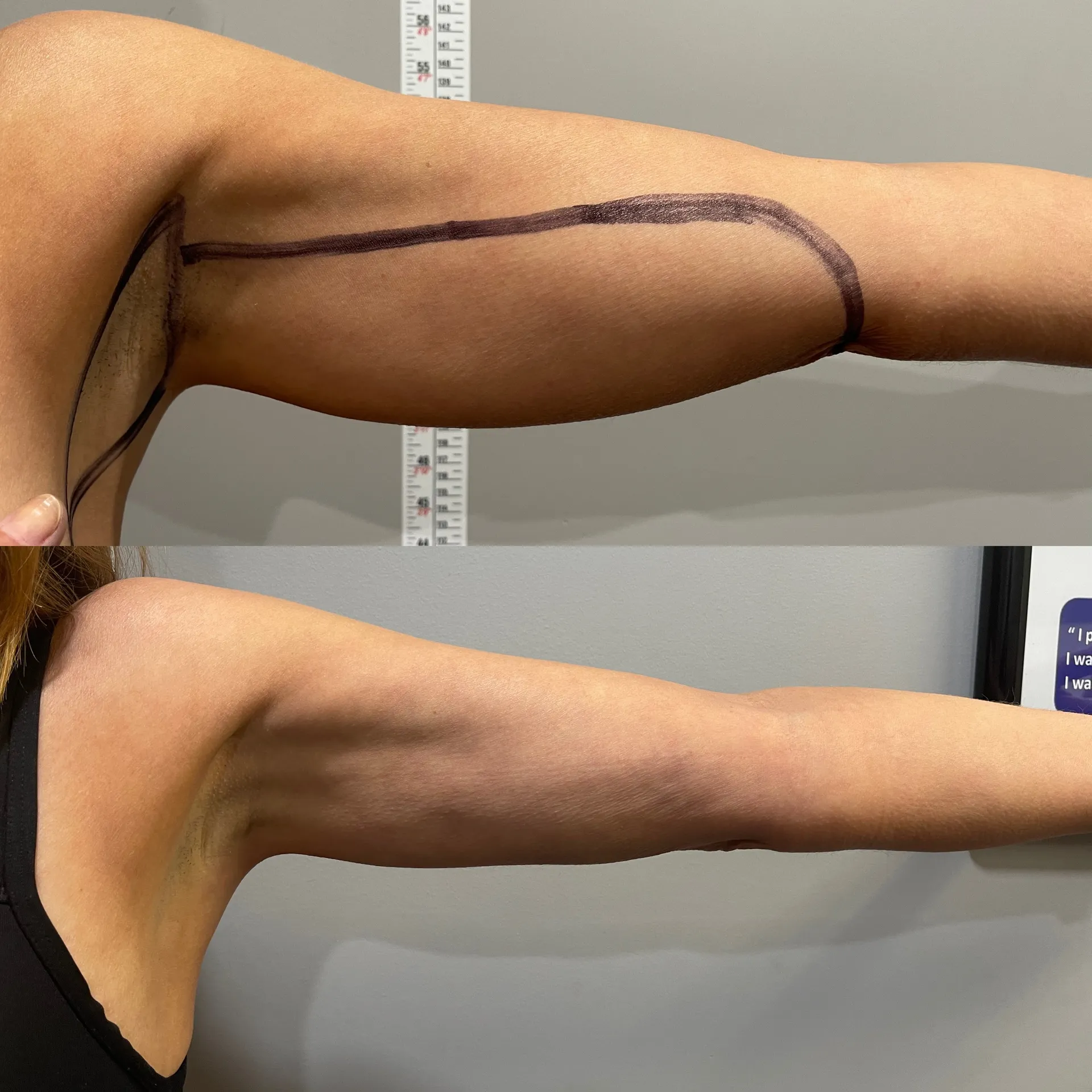 Featured before & after — case 34