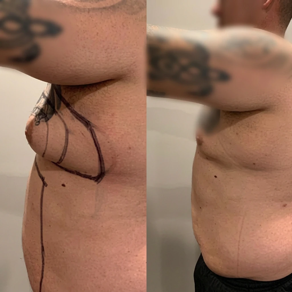 Men — Chest
