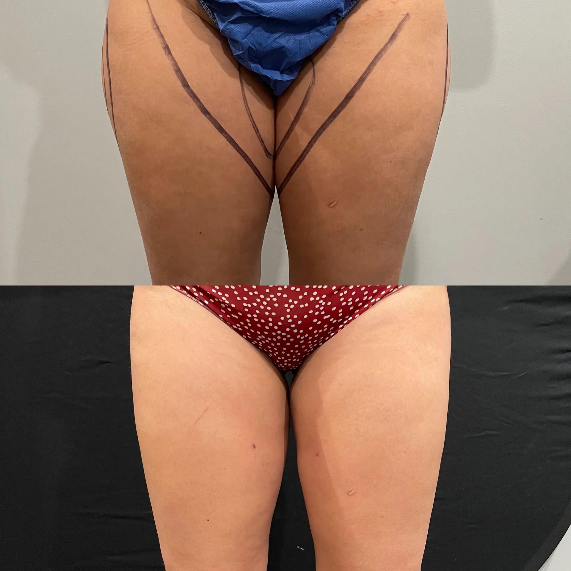 Results before & after — case 42