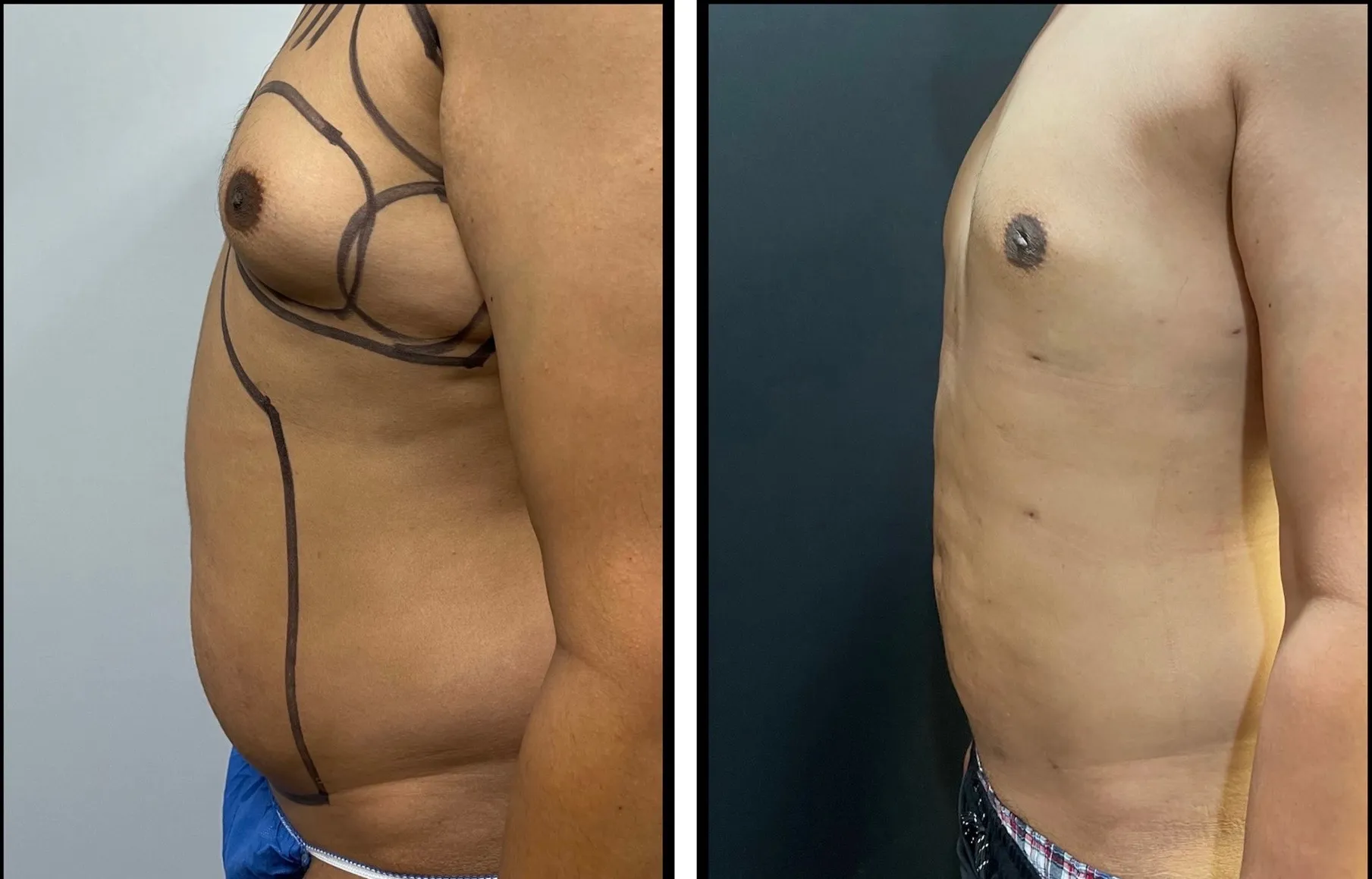 Results before & after — case 50