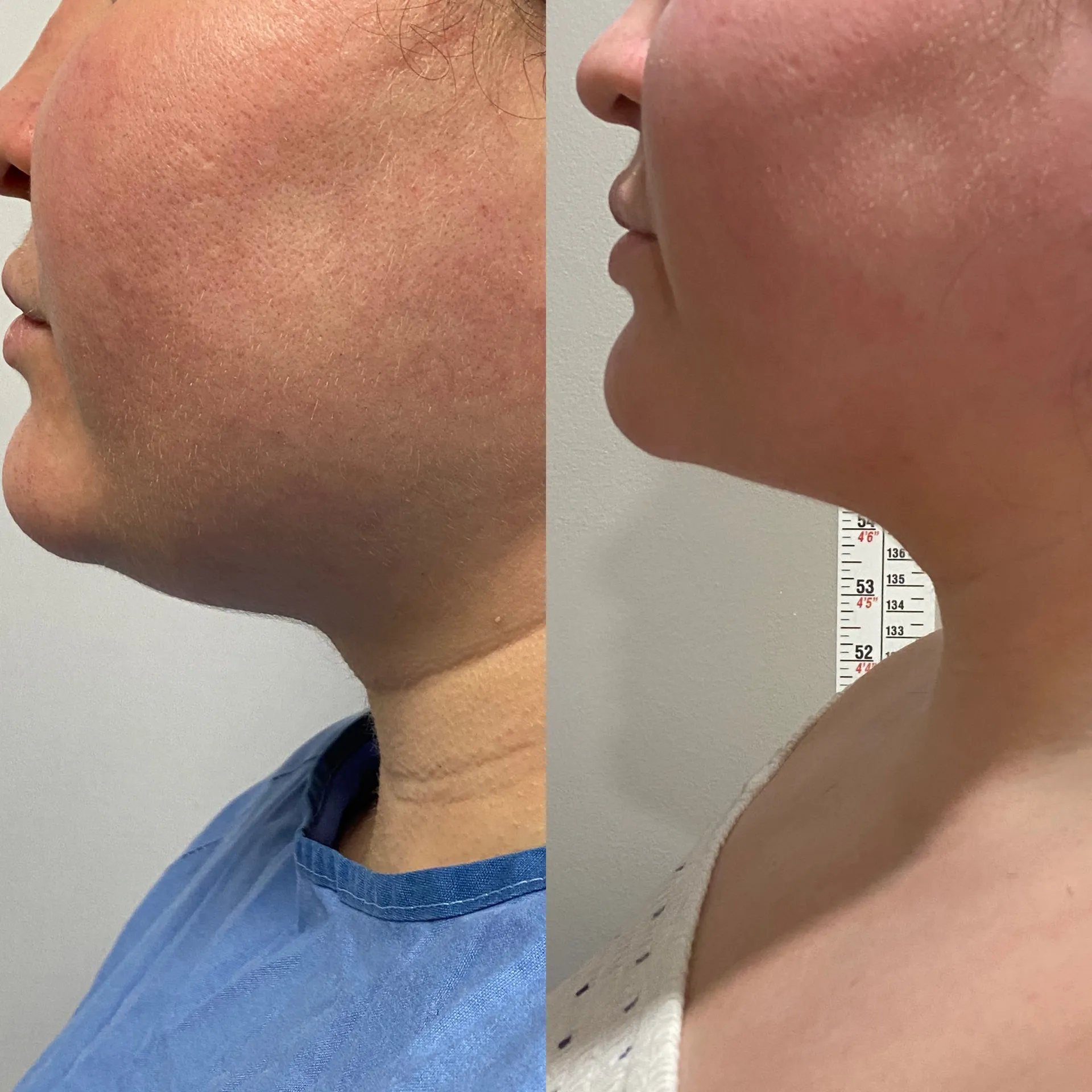 Featured before & after — case 38