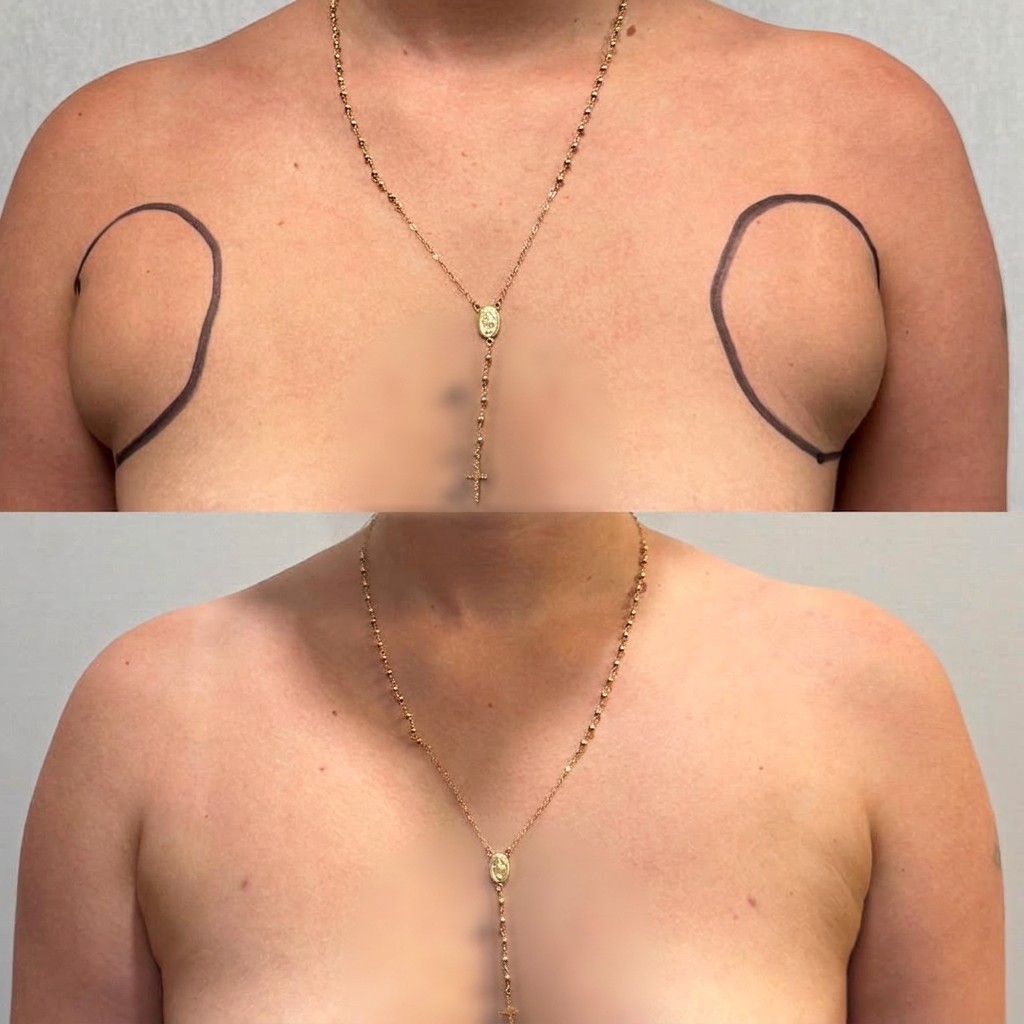 Women — Bra-Line