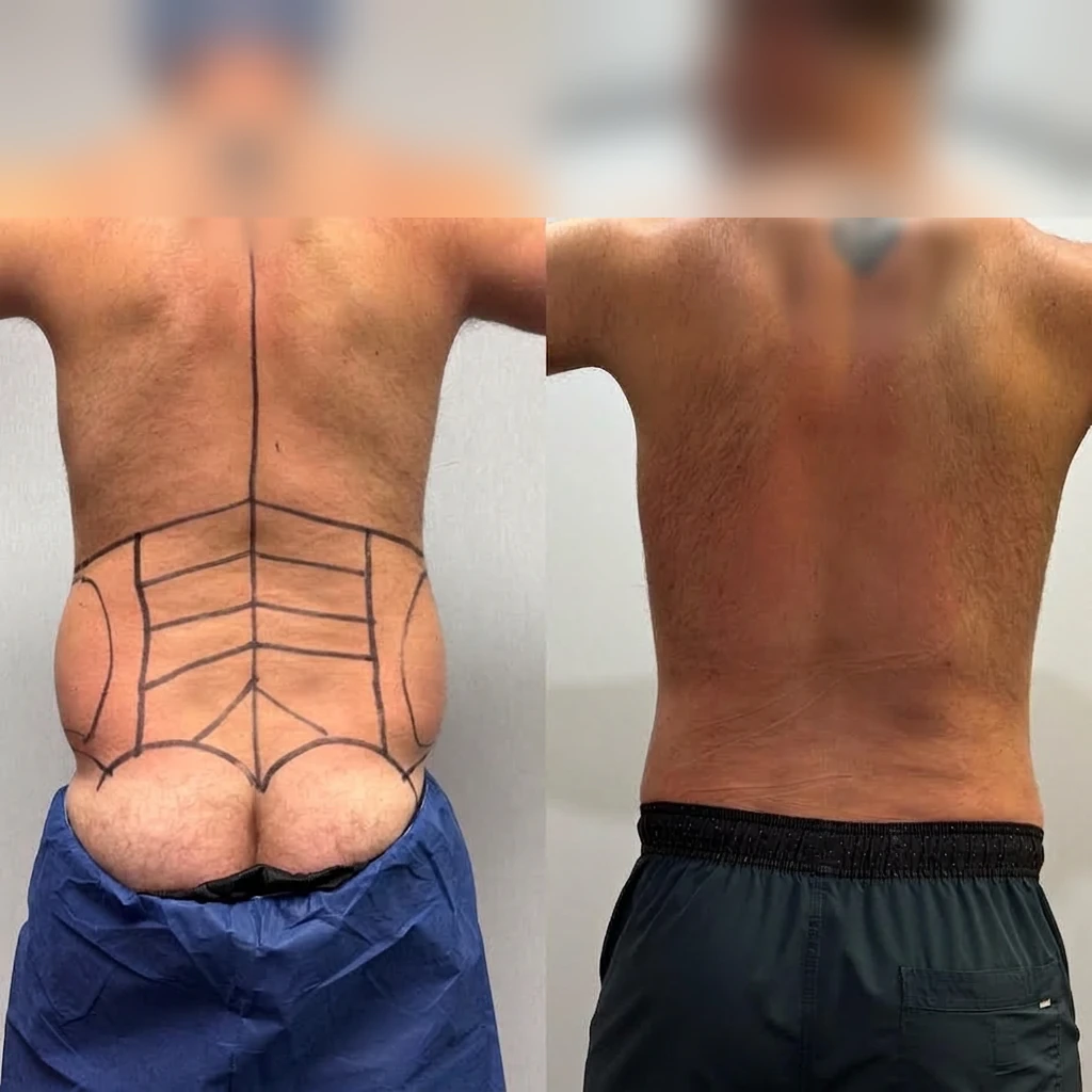 Men — Back