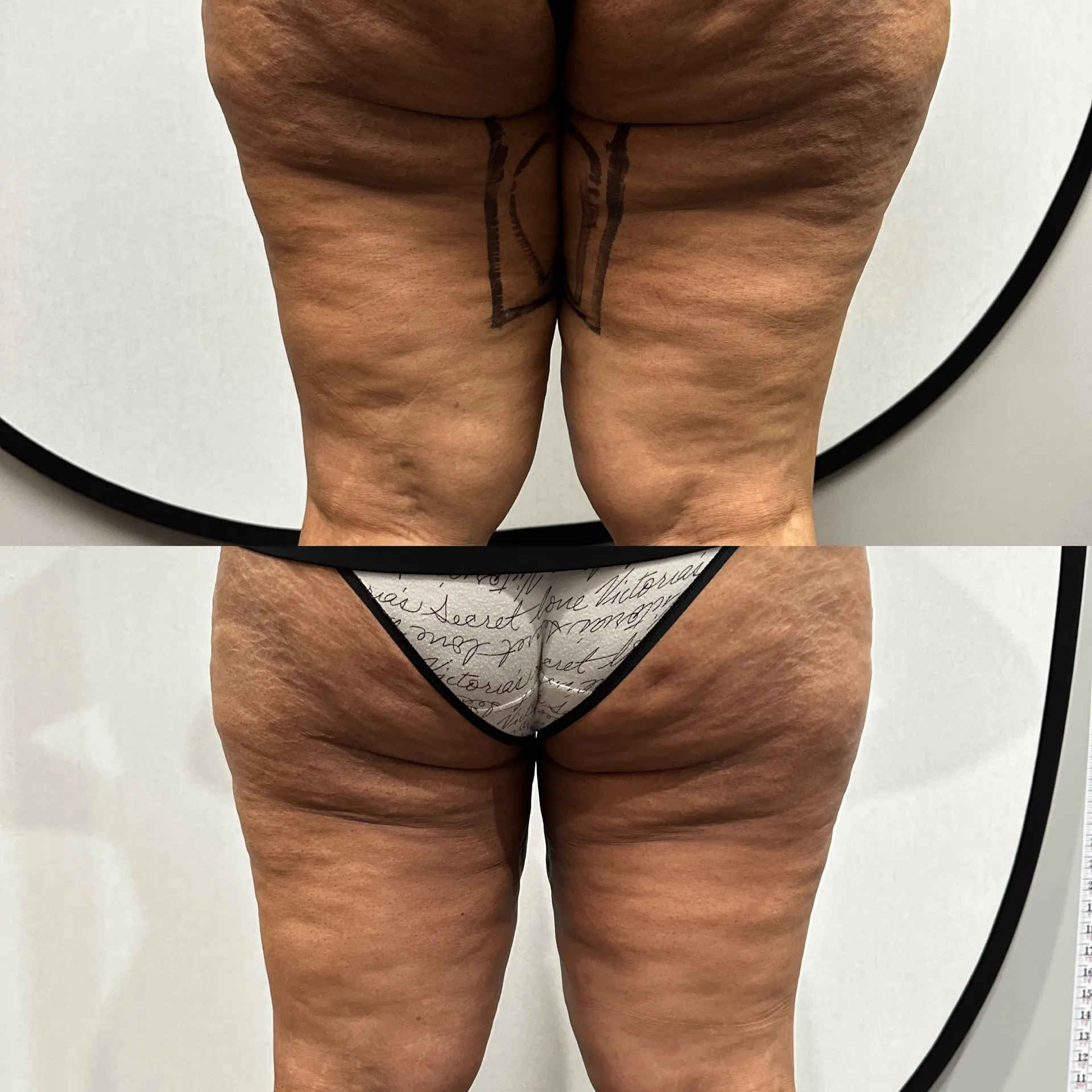 Featured before & after — case 41