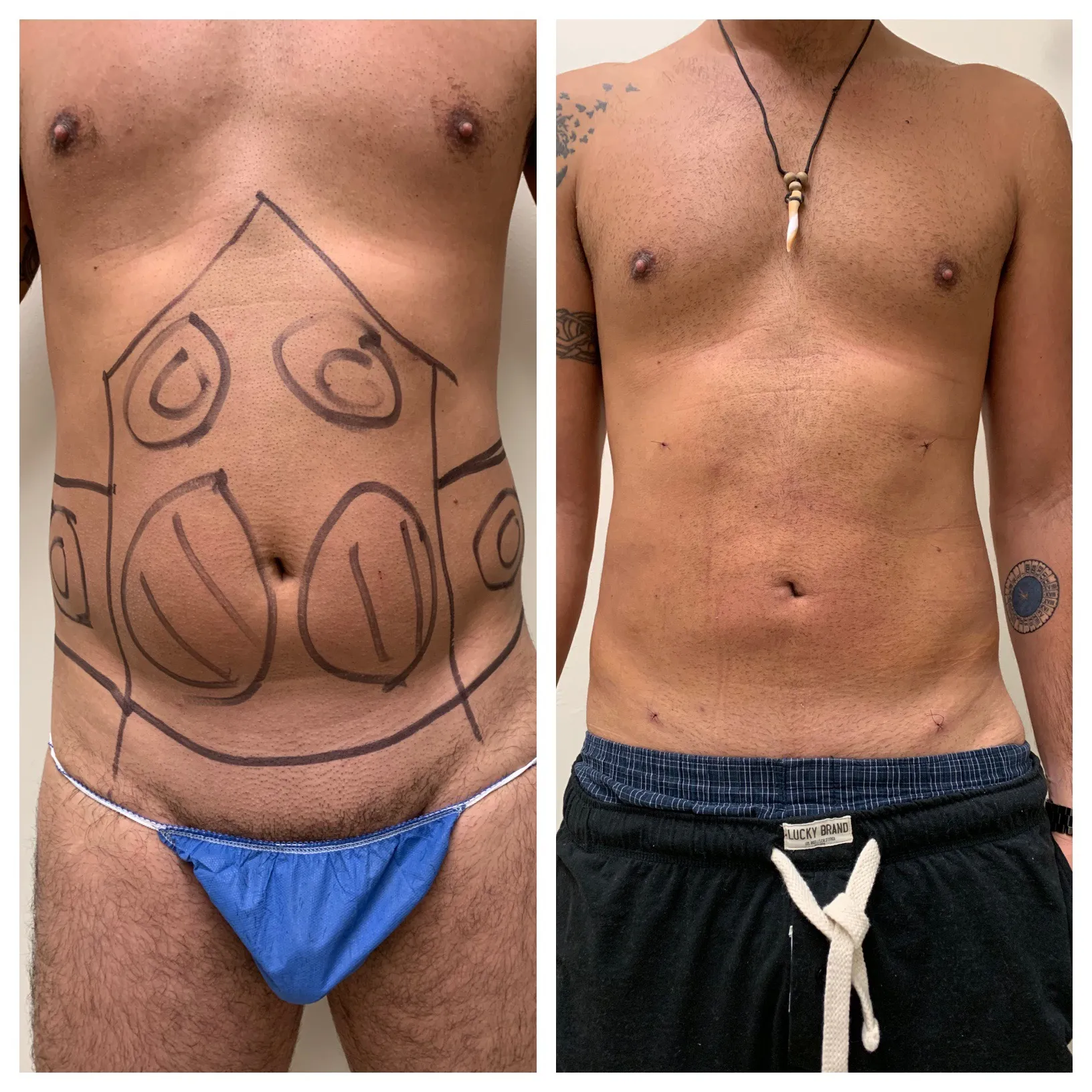 Results before & after — case 48