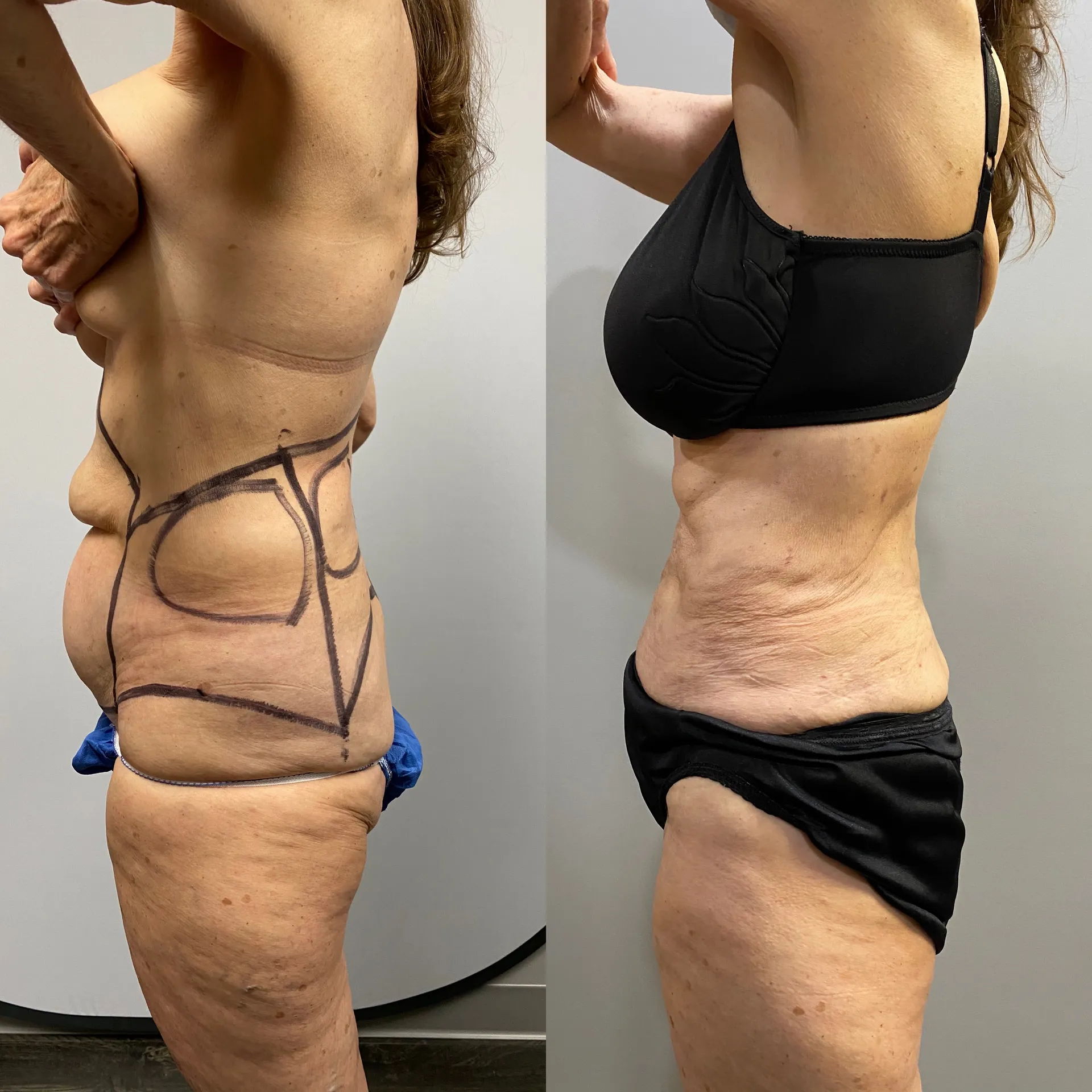 Results before & after — case 47